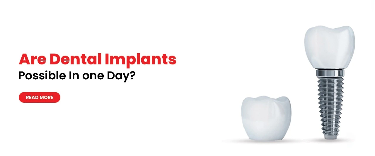 Are dental implants possible in one day?