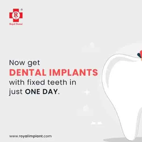 Dental Implant with Fixed Teeth in One Day